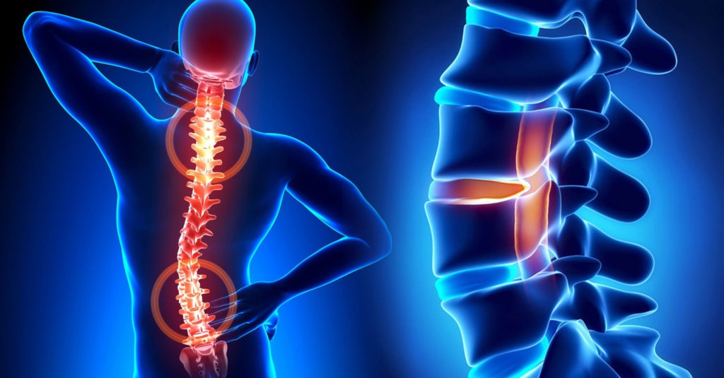 Лечение позвоночника и суставов